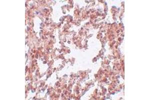 Immunohistochemistry (IHC) image for anti-Sushi-Repeat Containing Protein, X-Linked 2 (SRPX2) (N-Term) antibody (ABIN1031586) (SRPX2 抗体  (N-Term))