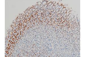 Immunohistochemistry (IHC) image for anti-Cofilin 1 (CFL1) (pSer3) antibody (ABIN6255180)