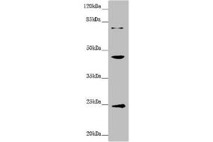 Western blot All lanes: GNA15 antibody at 1. (GNA15 抗体  (AA 1-374))