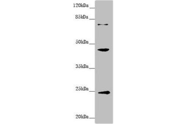 GNA15 抗体  (AA 1-374)