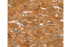 Immunohistochemistry (IHC) image for anti-ATP-Binding Cassette, Sub-Family C (CFTR/MRP), Member 9 (ABCC9) antibody (ABIN2433955) (ABCC9 抗体)