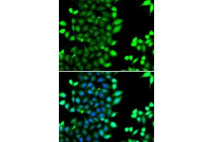 Immunofluorescence analysis of MCF-7 cells using RNF7 antibody (ABIN4905022). (RNF7 抗体)