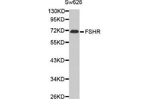 Western blot analysis of extracts of Sw626 cell line,using FSHR antibody. (FSHR 抗体)