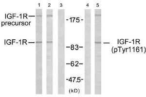 Western blot analysis using IGF-1R (Ab-1161) antibody (E021080, Line 1, 2 and 3) and IGF-1R (phospho-Tyr1161) antibody (E011087, Line 4 and 5). (IGF1R 抗体)