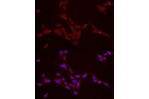 Immunofluorescence (IF) image for anti-Perilipin 2 (PLIN2) (AA 168-437) antibody (ABIN6145773)