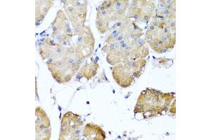 Immunohistochemistry of paraffin-embedded human stomach using NIN antibody (ABIN5974918) at dilution of 1/100 (40x lens). (Ninein 抗体)