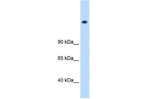 WB Suggested Anti-MED16 Antibody Titration: 0. (MED16 抗体  (N-Term))