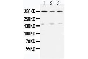 Anti-ATM antibody, Western blotting Lane 1: Rat Testis Tissue Lysate Lane 2: U87 Cell Lysate Lane 3: MCF-7 Cell Lysate (ATM 抗体  (N-Term))
