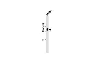 All lanes : Anti-TRBC1 Antibody (Center) at 1:500 dilution Lane 1: Molt-4 whole cell lysate Lysates/proteins at 20 μg per lane. (TRBC1 抗体  (AA 104-136))