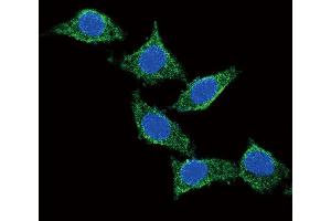 Confocal immunofluorescent analysis of ADCY Antibody (C-term) (ABIN651855 and ABIN2840424) with 293 cell followed by Alexa Fluor? (PACAP 抗体  (C-Term))