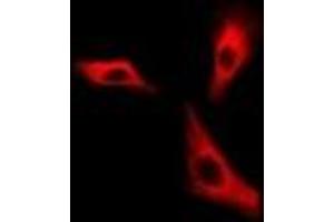 Immunofluorescent analysis of H6PD staining in A549 cells. (Glucose-6-Phosphate Dehydrogenase 抗体)