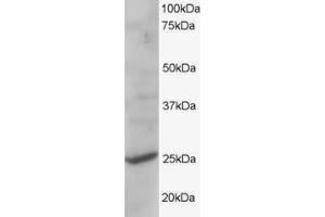 ABIN184844 staining (1µg/ml) of human liver lysate (RIPA buffer, 35µg total protein per lane). (CYB561D2 抗体  (C-Term))