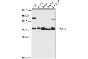 Western blot analysis of extracts of various cell lines, using NOL12 antibody  at 1:3000 dilution. (NOL12 抗体  (AA 1-213))