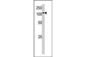 Western blot analysis of HK1 polyclonal antibody  in A-375 cell lysate. (Hexokinase 1 抗体  (C-Term))