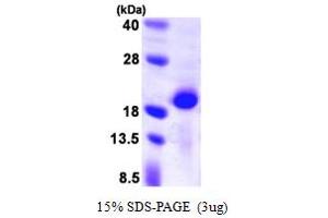 SDS-PAGE (SDS) image for Calcineurin B (CAN) (AA 1-173) protein (His tag) (ABIN667404) (Calcineurin B Protein (CAN) (AA 1-173) (His tag))