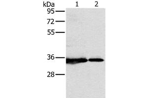 Western Blot analysis of 231 and Jurkat cell using NDUFAF1 Polyclonal Antibody at dilution of 1:500 (NDUFAF1 抗体)