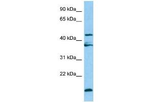 WB Suggested Anti-LGMN Antibody Titration: 1. (LGMN 抗体  (Middle Region))