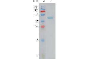 SDS-PAGE (SDS) image for Chemokine (C-C Motif) Ligand 5 (CCL5) (AA 24-91) protein (Fc Tag) (ABIN7538182)