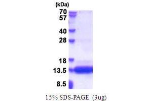 SDS-PAGE (SDS) image for Chondrosarcoma Associated Gene 1 (CSAG1) (AA 20-78) protein (His tag) (ABIN5853657) (CSAG1 Protein (AA 20-78) (His tag))