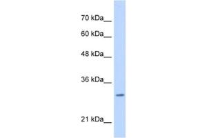 Western Blotting (WB) image for anti-Myeloid Leukemia Factor 2 (MLF2) antibody (ABIN2462989) (MLF2 抗体)