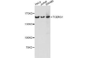 Western blot analysis of extracts of various cell lines, using TCERG1 antibody. (TCERG1 抗体)