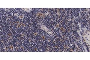 ABIN6267686 at 1/100 staining human Lymph node tissue sections by IHC-P. (ASK1 抗体  (pSer966))
