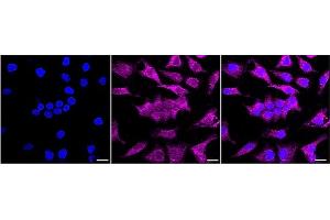 anti-MAP-Kinase Activating Death Domain (MADD) antibody