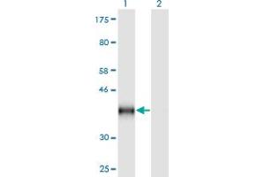 Western Blot analysis of CD59 expression in transfected 293T cell line by CD59 monoclonal antibody (M02), clone 3G6. (CD59 抗体  (AA 1-128))