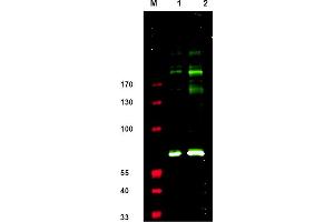 Western blot using anti-IRS1 pS307 antibody shows detection. (IRS1 抗体  (pSer307))