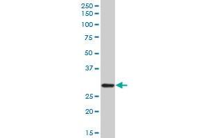 Western Blotting (WB) image for anti-Complement Component 1, Q Subcomponent, A Chain (C1QA) (AA 23-245) antibody (ABIN513848)