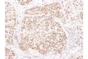 Immunohistochemistry (IHC) image for anti-Polymerase (DNA Directed), delta 1, Catalytic Subunit 125kDa (POLD1) (AA 50-100) antibody (ABIN7453541)