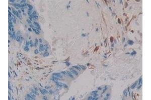 Immunohistochemistry (IHC) image for anti-Calbindin 2 (CALB2) (AA 28-248) antibody (ABIN7432391)