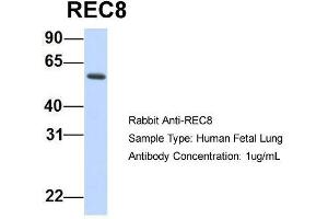 Host:  Rabbit  Target Name:  REC8  Sample Type:  Human Fetal Lung  Antibody Dilution:  1. (REC8 抗体  (N-Term))