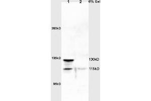 Lane 1: rat lung lysates Lane 2: rat brain lysates probed with Anti NOS-2/iNOS Polyclonal Antibody, Unconjugated (ABIN725675) at 1:200 in 4 °C. (NOS2 抗体)