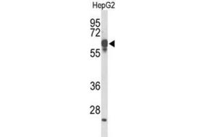 Western Blotting (WB) image for anti-F-Box and Leucine-Rich Repeat Protein 5 (FBXL5) antibody (ABIN3004167) (FBXL5 抗体)