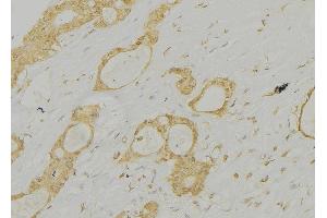ABIN6277313 at 1/100 staining Human lung tissue by IHC-P. (Cathepsin E 抗体  (Internal Region))
