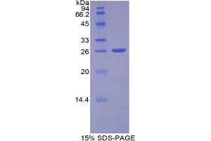 SDS-PAGE analysis of Human ADAM10 Protein. (ADAM10 蛋白)