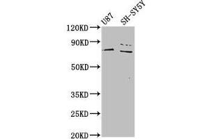 Western Blot Positive WB detected in: U87 whole cell lysate, SH-SY5Y whole cell lysate All lanes: TIPARP antibody at 4. (Tiparp 抗体  (AA 74-178))