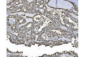 IHC analysis of P4HB using anti-P4HB antibody (ABIN7600075). (P4HB 抗体  (AA 146-363))