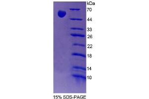 SDS-PAGE analysis of Rat FARS2 Protein. (FARS2 蛋白)