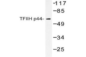Western blot (WB) analysis of TFIIH p44 antibody in extracts from COLO205 (GTF2H2 抗体)