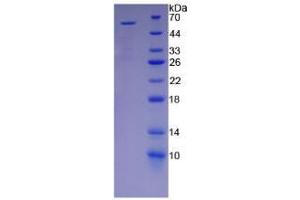 SDS-PAGE analysis of Human KIR2DS2 Protein. (KIR2DS2 蛋白)