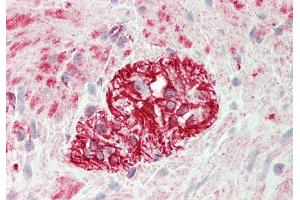 Rabbit Anti-KLHL25 antibody  Formalin Fixed Paraffin Embedded Tissue: Human Colon, Myenteric Plexus Primary antibody Concentration: 1:100 Secondary Antibody: Donkey anti-Rabbit-Cy3 Secondary Antibody Concentration: 1:200 Magnification: 20x Exposure Time: 0. (KLHL25 抗体  (N-Term))