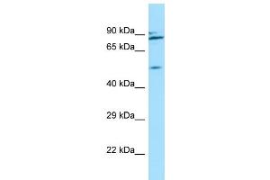 WB Suggested Anti-NUP54 Antibody Titration: 1. (NUP54 抗体  (C-Term))