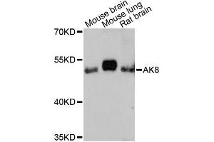 Western blot analysis of extracts of various cell lines, using AK8 antibody (ABIN6292827) at 1:3000 dilution. (AK8 抗体)