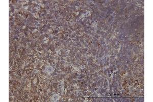 Immunoperoxidase of monoclonal antibody to RPL9 on formalin-fixed paraffin-embedded human tonsil tissue. (RPL9 抗体  (AA 93-191))