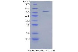 SDS-PAGE analysis of Human LFA1A Protein. (ITGAL 蛋白)