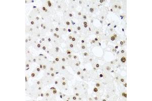 Immunohistochemistry of paraffin-embedded human liver injury using H2AFX antibody (ABIN4903860) at dilution of 1:100 (40x lens). (H2AFX 抗体)