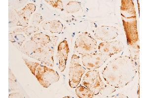 ABIN6267073 at 1/100 staining human heart tissue sections by IHC-P. (CHEK1 抗体  (pSer280))
