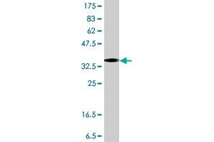 Western Blot detection against Immunogen (38. (GLI3 抗体  (AA 1-110))